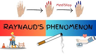 Raynauds Phenomenon EXPLAINED CLEARLY  Pathophysiology Causing factors and Classification [upl. by Endora]