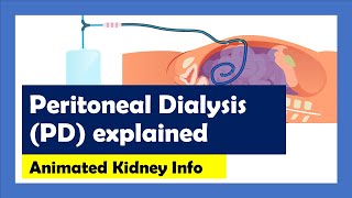 Peritoneal Dialysis explained [upl. by Orth]