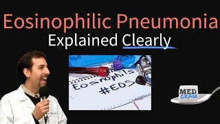 Eosinophilic Pneumonia Explained Clearly by MedCramcom [upl. by Kleiman]