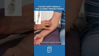 Is Your Wrist Pain Caused By Trigger Points In the Forearm Flexors [upl. by Yllier]