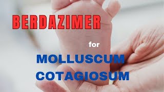 MOLLUSCUM CONTAGIOSUM Treatment update  BERDAZIMER GEL [upl. by Eiramnerual]