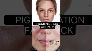 PIGMENTATION PACK gonaturesoap [upl. by Novah]