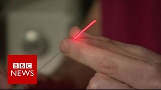 Prostate cancer laser treatment truly transformative  BBC News [upl. by Aniluj]