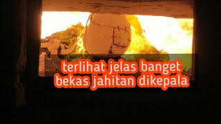 PROSES KREMASI  TERLIHAT JELAS BEKAS JAHITAN DIKEPALANYA [upl. by Egor820]