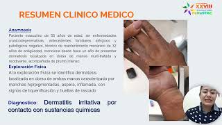 CC 2 Uso de clobetasol en dermatitIs por contacto irritativa por sustancias químicas [upl. by Eiramllij]