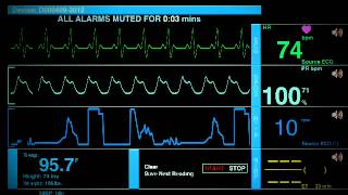 Sonido De Un Hospital [upl. by Eustache]