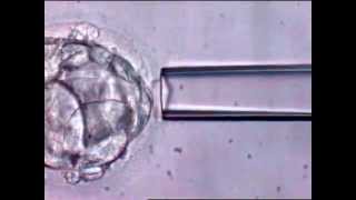 EMBRYO BIOPSY VIDEO [upl. by Petit]