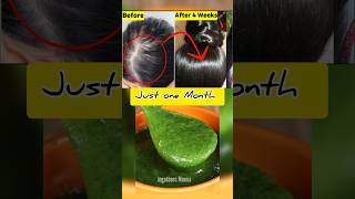 😱உங்க தலையில் முடி இல்லையா Just One Month 🔥Get New Hair😱 baldness tips [upl. by Siegfried847]