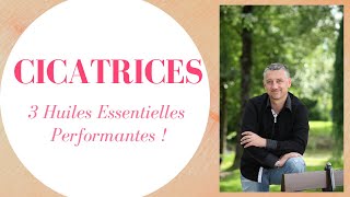 3 huiles efficaces contre les cicatrices sur le corps [upl. by Freda]