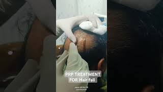 PRP Best hair loss treatment short video [upl. by Prospero]