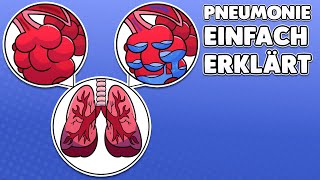 Pneumonie Erklärung Was Pfleger wissen MÜSSEN [upl. by Yelreveb62]