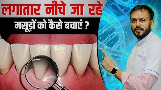 नीचे जा रहे मसूड़ो का घरेलू इलाज  Best Home Remedies for Gum Recession Hindi [upl. by Rori]