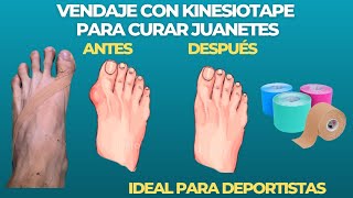 VENDAJE SENCILLO y EFICAZ para CURAR JUANETES con KINESIOTAPE [upl. by Alaehcim294]