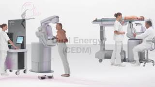 GIOTTO CLASS DIGITAL MAMMOGRAPHY [upl. by Innus]