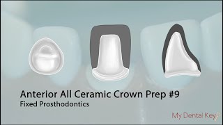 PASS THE CDCA  All Ceramic Anterior Crown Preparation  My Dental Key [upl. by Will]