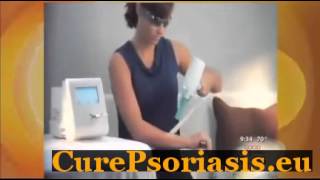 Vitamin C For Psoriasis [upl. by Alyat]