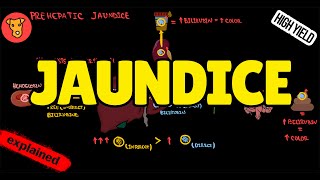 JAUNDICE Classification Pathogenesis Types of Jaundice Why urine is yellow [upl. by Ziana207]