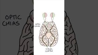 Bitemporal Hemianopia medicine clinicalexamination ophthalmology [upl. by Eidaj956]