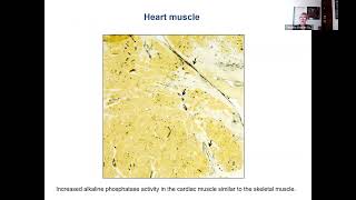 Myositis and Heart Disease with Dr Christina CharlesSchoeman [upl. by Duester]