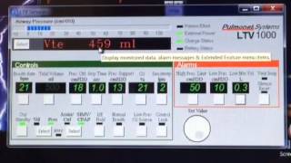 SILENCERESET VENT INOP LTV VENTILATORS EXPLAINED [upl. by Acira]