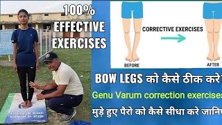 Bow Legs को कैसे ठीक करे । Genu Varum correction exercise in Hindi 100 effective exercises 🦵 [upl. by Ahsiakal621]