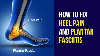 plantar fascitis heel pain [upl. by Neibart317]