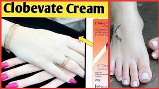 Clobevate Hand amp Foot Whitening Cream Best Formula whitening cream for handsAmazing Results [upl. by Adnuahsor727]