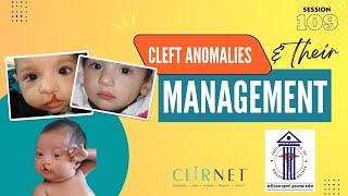 Anesthesia for Cleft anomalies  ICA Webinar 109 [upl. by Husha]