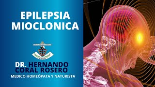 EPILEPSIA MIOCLONICA [upl. by Egbert]