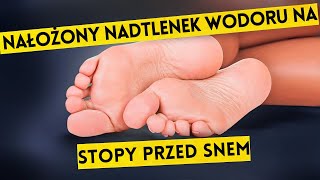 Oto Co Się Stało Już Po 2 Razach Nadtlenek Wodoru na Stopy [upl. by Wanids]