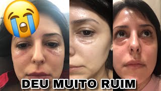 MEU PREENCHIMENTO DE OLHEIRAS QUE DEU ERRADO  MILENA BARBOSA [upl. by Dionisio]