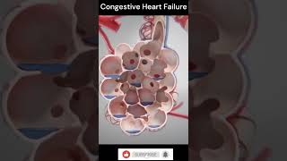 Congestive Heart Failure Explain 3DAnimation shorts [upl. by Conrade]