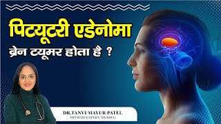 Pituitary Adenoma क्या होता है क्या Pituitary Adenoma सच में Brain Tumor है Dr Tanvi Mayur Patel [upl. by Enortna]