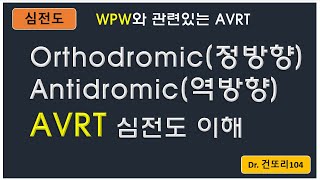 orthodromic정방향antidromic역방향 AVRT 심전도ECG 이해 [upl. by Demaggio]