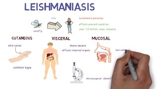 What is Leishmaniasis An introduction and overview [upl. by Cathryn]