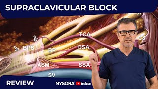 Supraclavicular Block WHY HOW WHERE AND WHAT’S NEW [upl. by Huntlee]