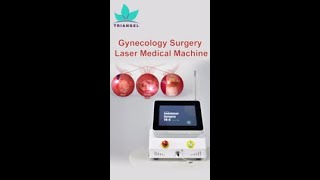 980nm 1470nm diode laser machine for gynecology TRIANGEL TRC [upl. by Elleuqram286]