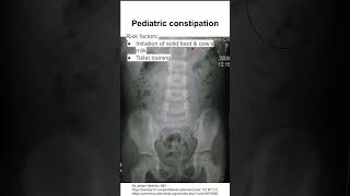 Pediatric constipation [upl. by Savitt]