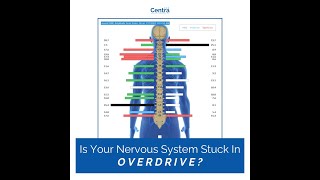 Stress Kills  How To Measure The Stress In Your Life [upl. by Colman]