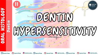 Dentin Hypersensitivity  Direct innervation  Transduction  Hydrodynamic theory  Dr Paridhi [upl. by Nara]