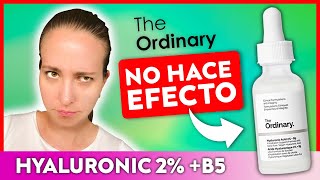 La CRUDA VERDAD sobre el Hyaluronic 2  B5  The Ordinary [upl. by Fachini]