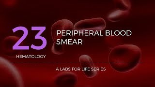 Part 1  Preparation of Peripheral Blood Smear PBS [upl. by Meenen302]