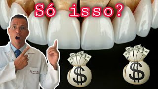 QUANTO CUSTA LENTES DE CONTATO DENTAL  AntesDepois VOU FALAR O PREÇO Vídeo COMPLETO pra DECIDIR [upl. by Nacim643]