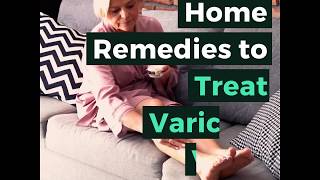 Home Remedies to Treat Varicose Veins [upl. by Lacee702]