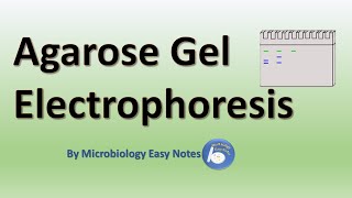 Agarose gel electrophoresis [upl. by Martita914]