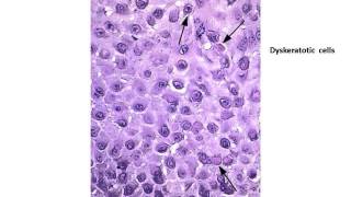 Answers to Basic dermatopathology quiz Dr shashikala krishnamurthy [upl. by Enitsuga]