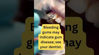 The Shocking Reason Your Gums Are Bleeding Every Morning [upl. by Waldon]