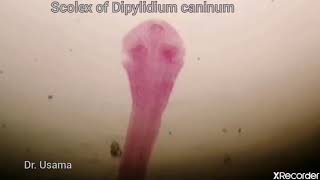 Dipyilidium caninum [upl. by Nwotna777]