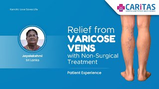 Relief from Varicose Veins with NonSurgical Treatment patienttestimonial srilanka [upl. by Mahmud717]