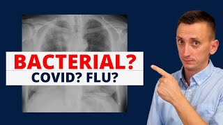 Covid Influenza Pneumonia [upl. by Englebert196]